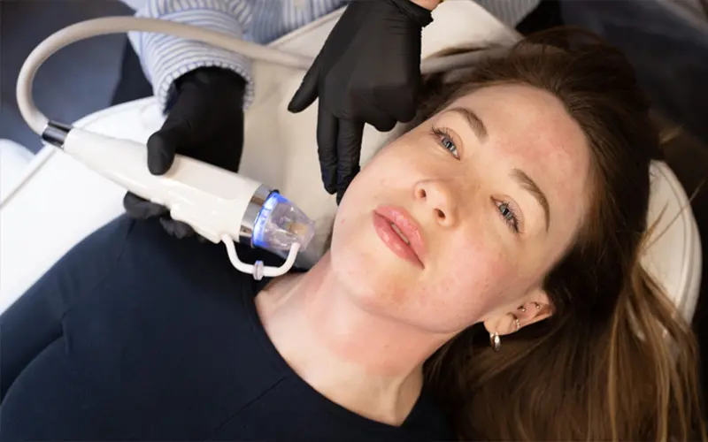 Microneedle Fractional RF for face