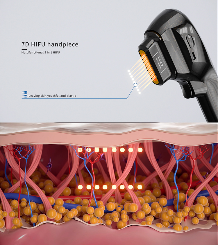 7D HIFU Handpiece