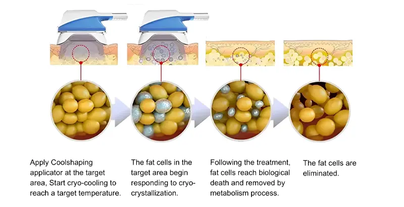 what is cryo 360