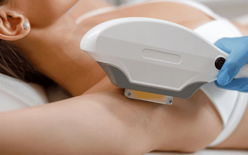 IPL Handles for Hair Removal