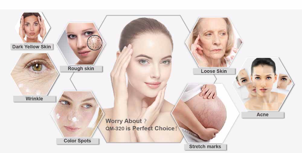 Microneedle Fractional RF machine Application