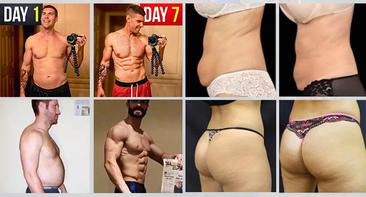 EMS Body Sculpting & Pelvic Health Device Before & After