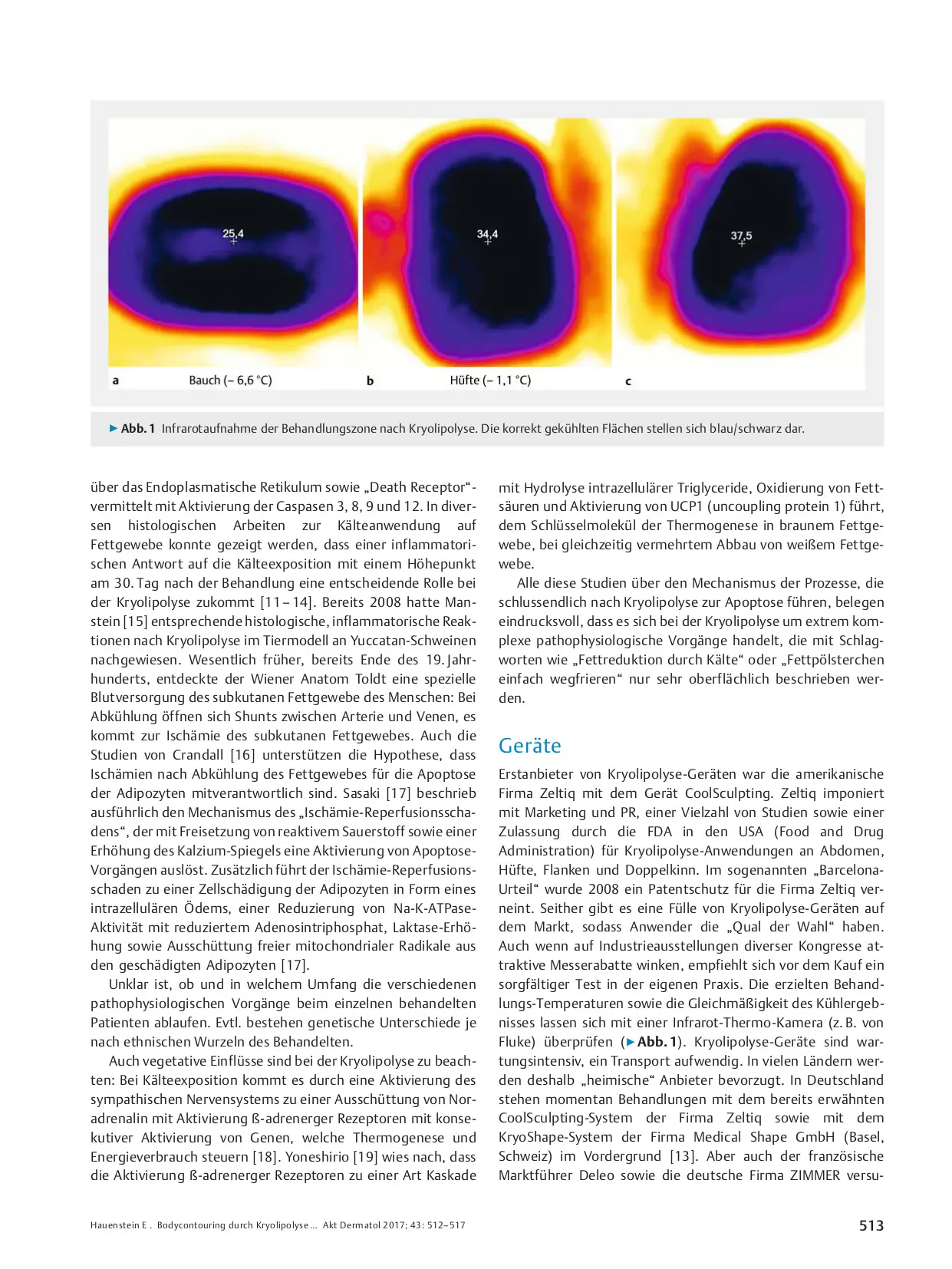 Body Contouring by Cryolipolysis – Research and Practice