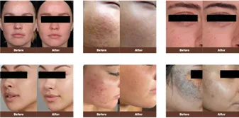 Before and after treatment comparison pictures
