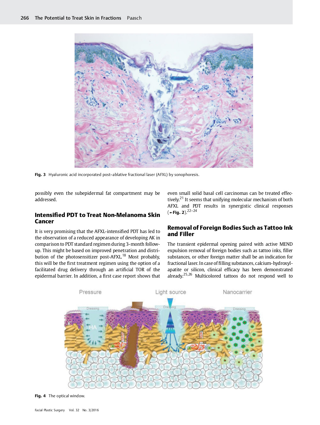 The Future of Fractional Lasers