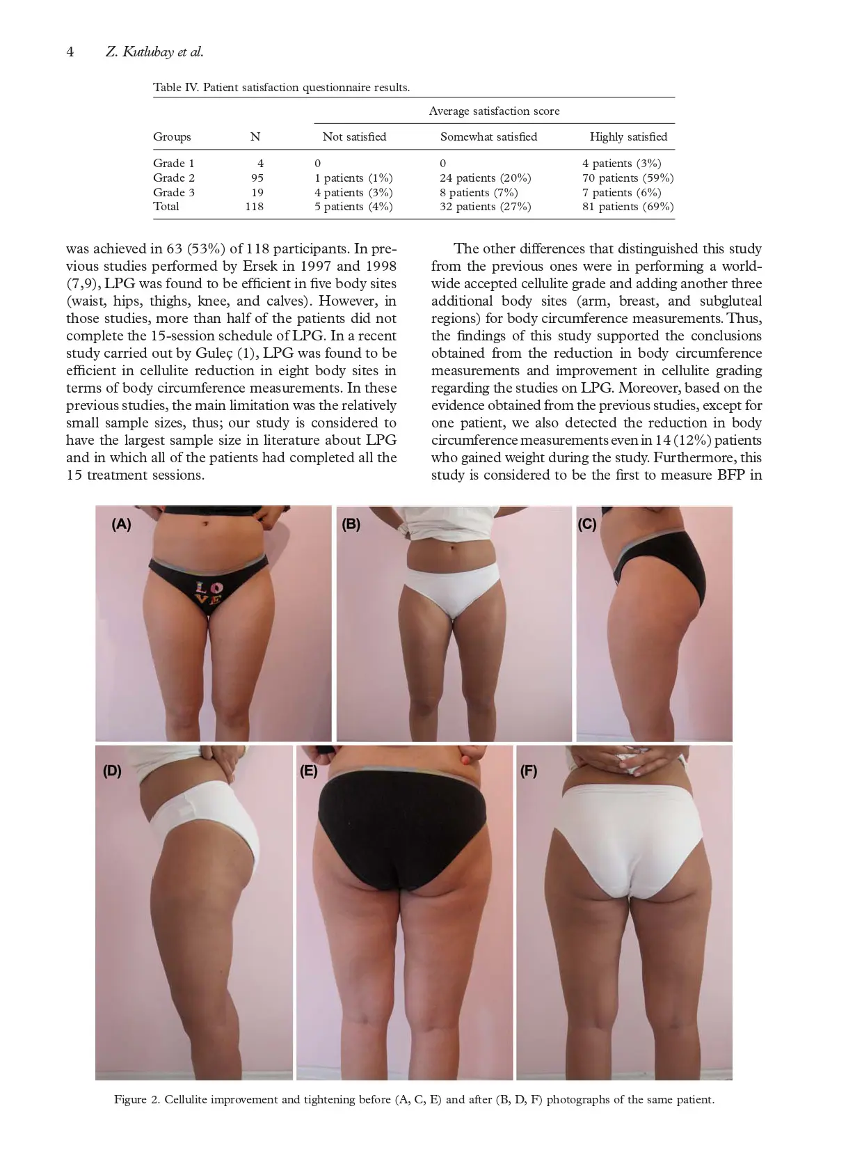 An alternative treatment modality for cellulite LPG endermologie