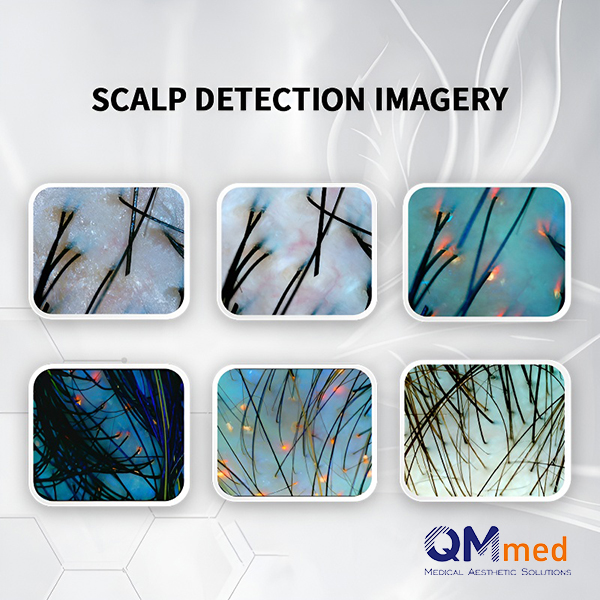 Scalp Detection