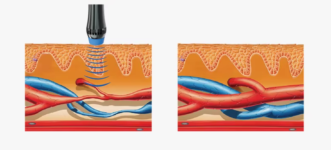 Shockwave Machine Application