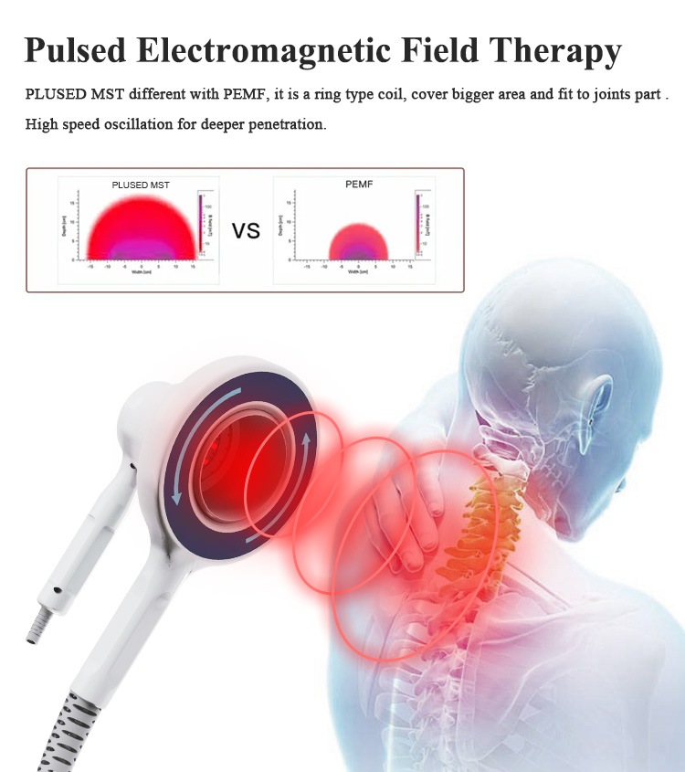 Pulsed Electromagnetic Field Therapy