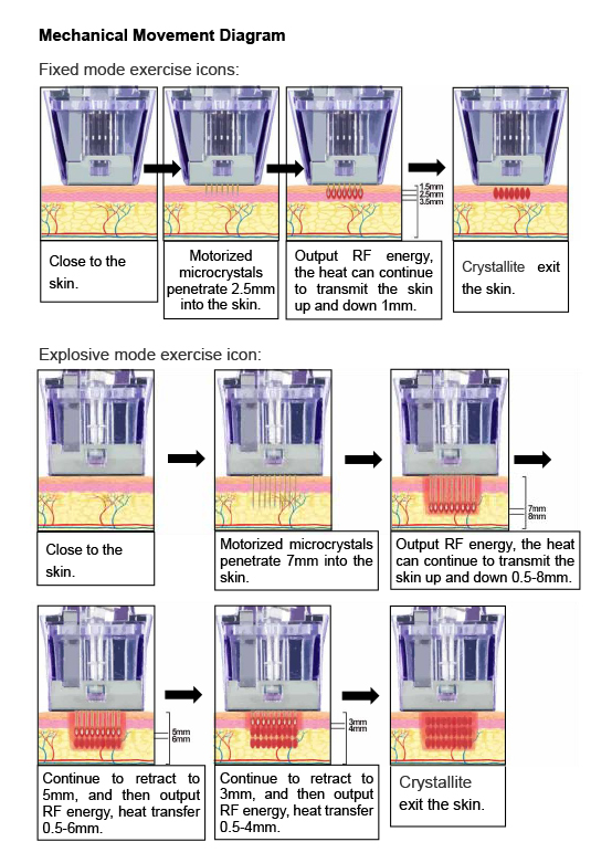 How Microneedle Radiofrequency (RF) work ?