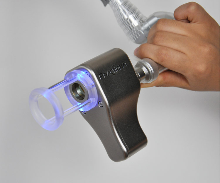 Fractional Laser