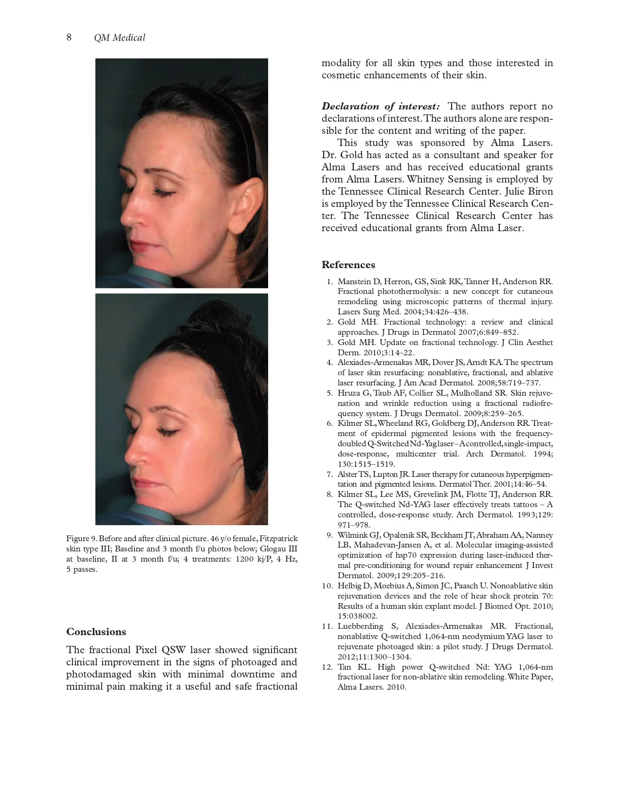 Fractional Q-Switched 1,064-nm laser for the treatment of photoaged-photodamaged skin