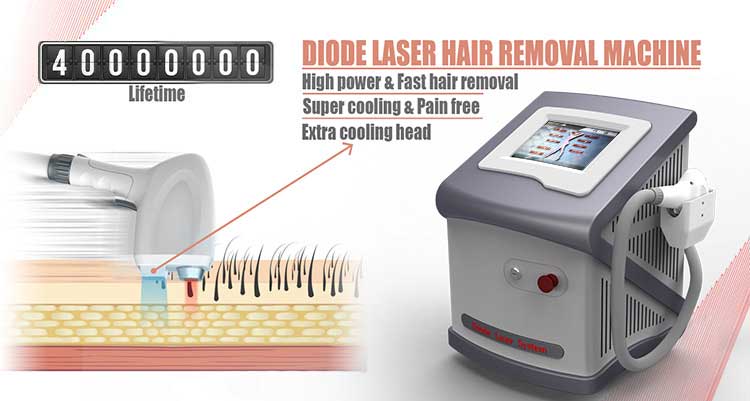 High power & Fast hair removal machine