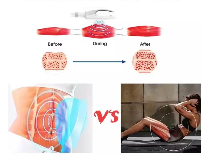 How does the ems machine work?