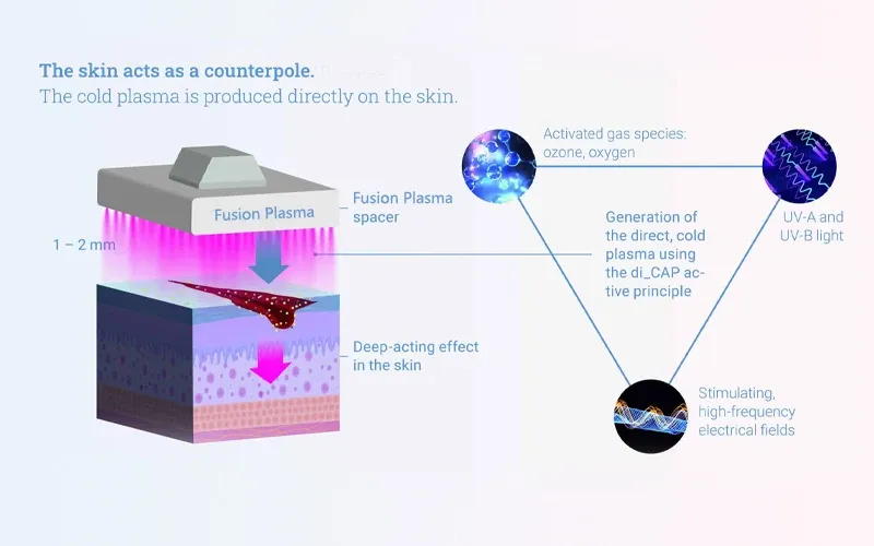 How does Fusion Plasma work?