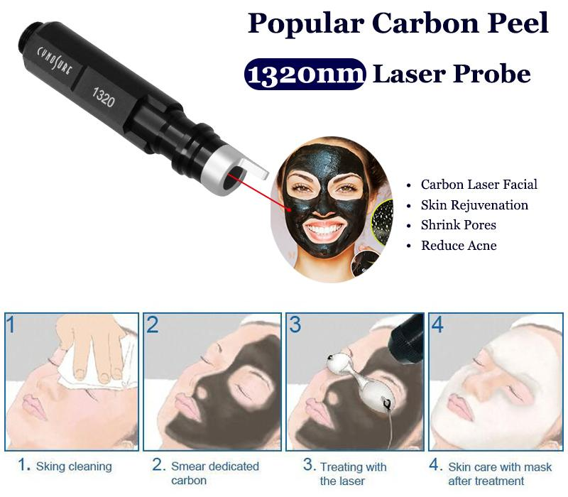 Carbon Peel