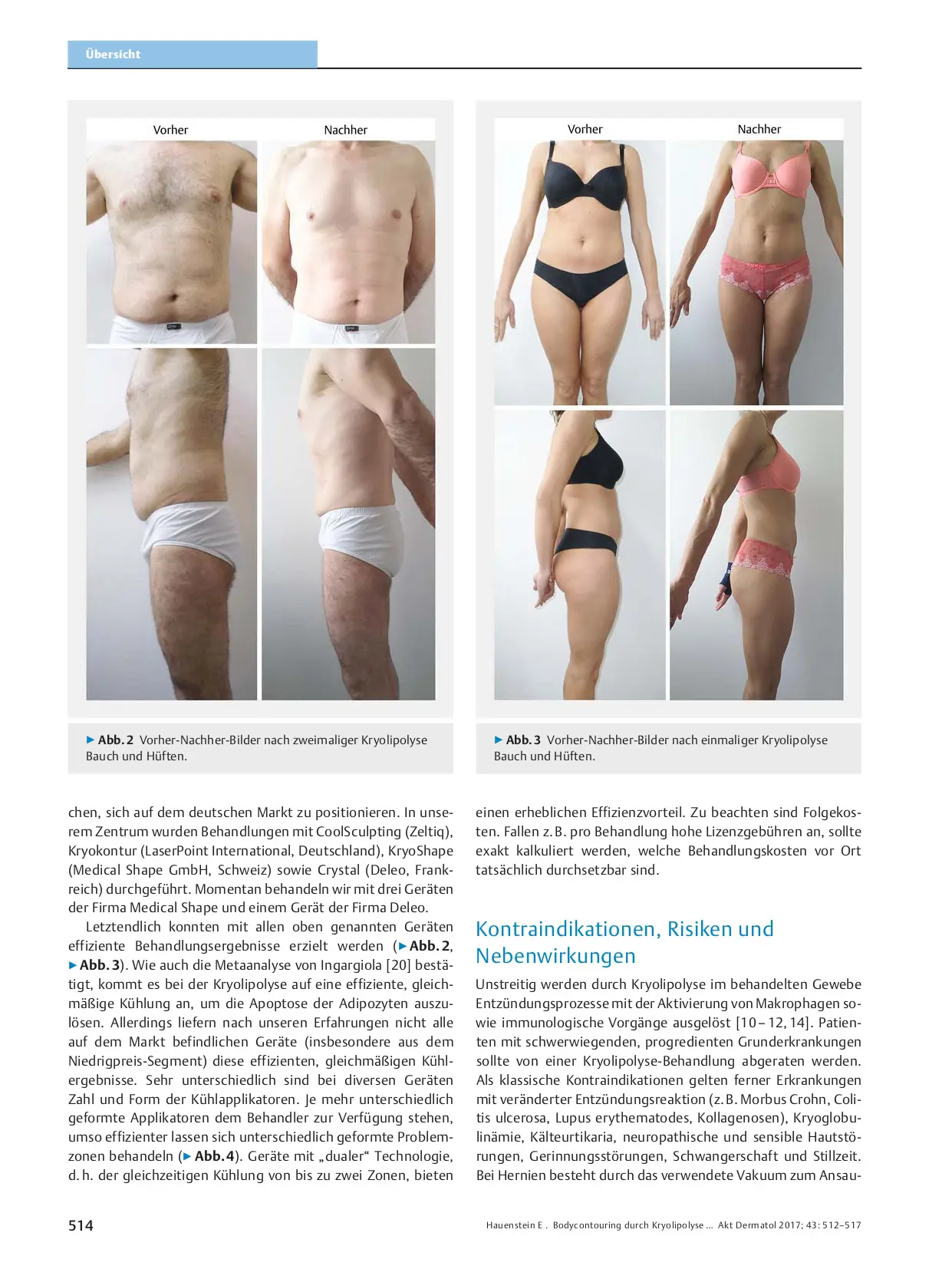 Body Contouring by Cryolipolysis – Research and Practice