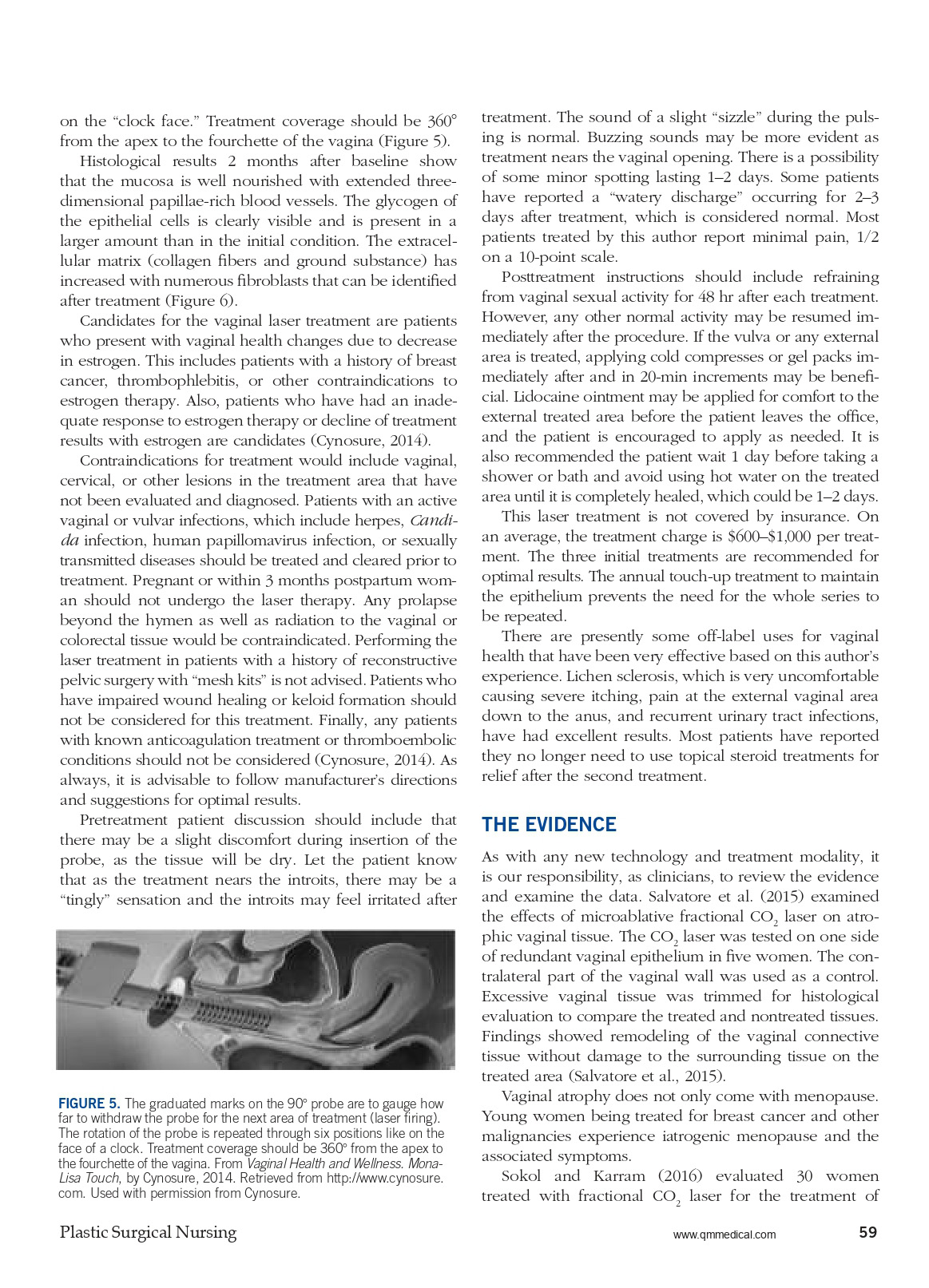 Vaginal Health and Wellness Vaginal Laser Therapy