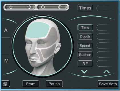 Smart Interface