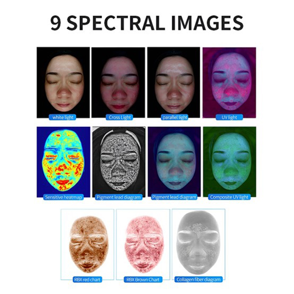 Multispectral Skin and Scalp Analyzer