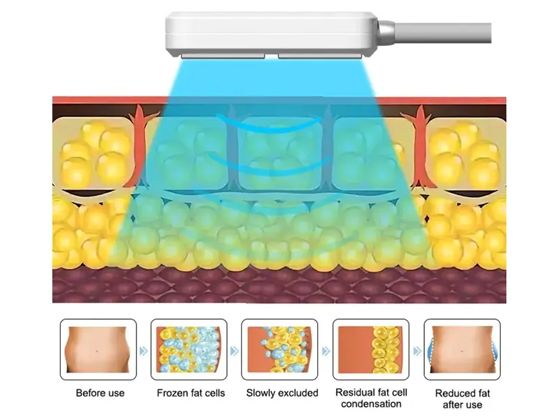 How does the Cooling Pads work?