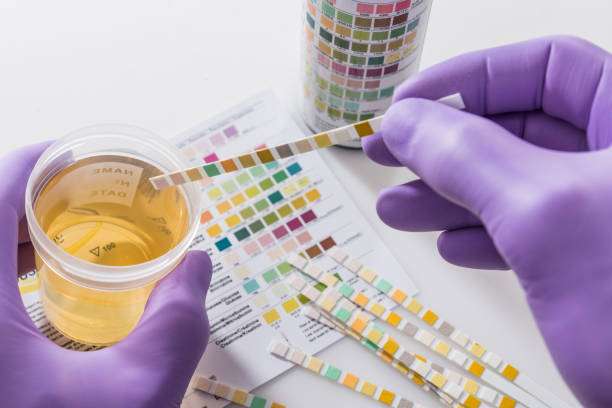 urine dipstick test strips