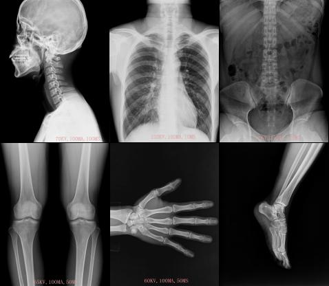 the clinical images of the digital x ray system.