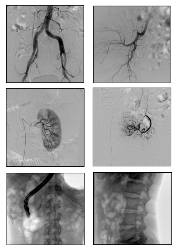 clinical images of the syrj c2200 mobile c arm.