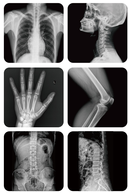 the clinical images of the dr digital radiography.