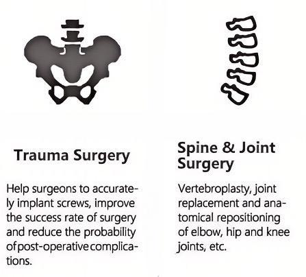 trauma surgery and joint surgery of the mobile c arm.