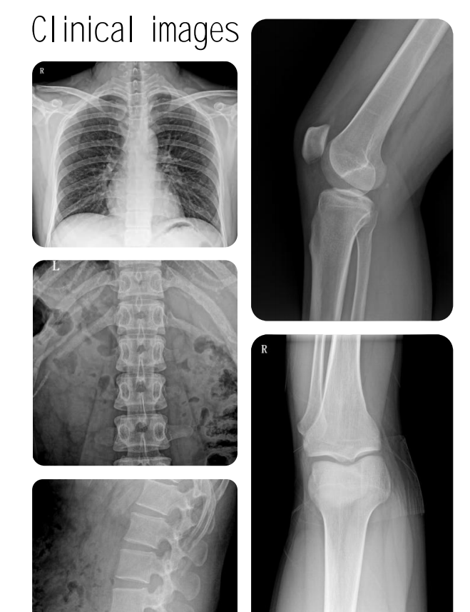 clinical images of the syrj dr750 x ray dr system.