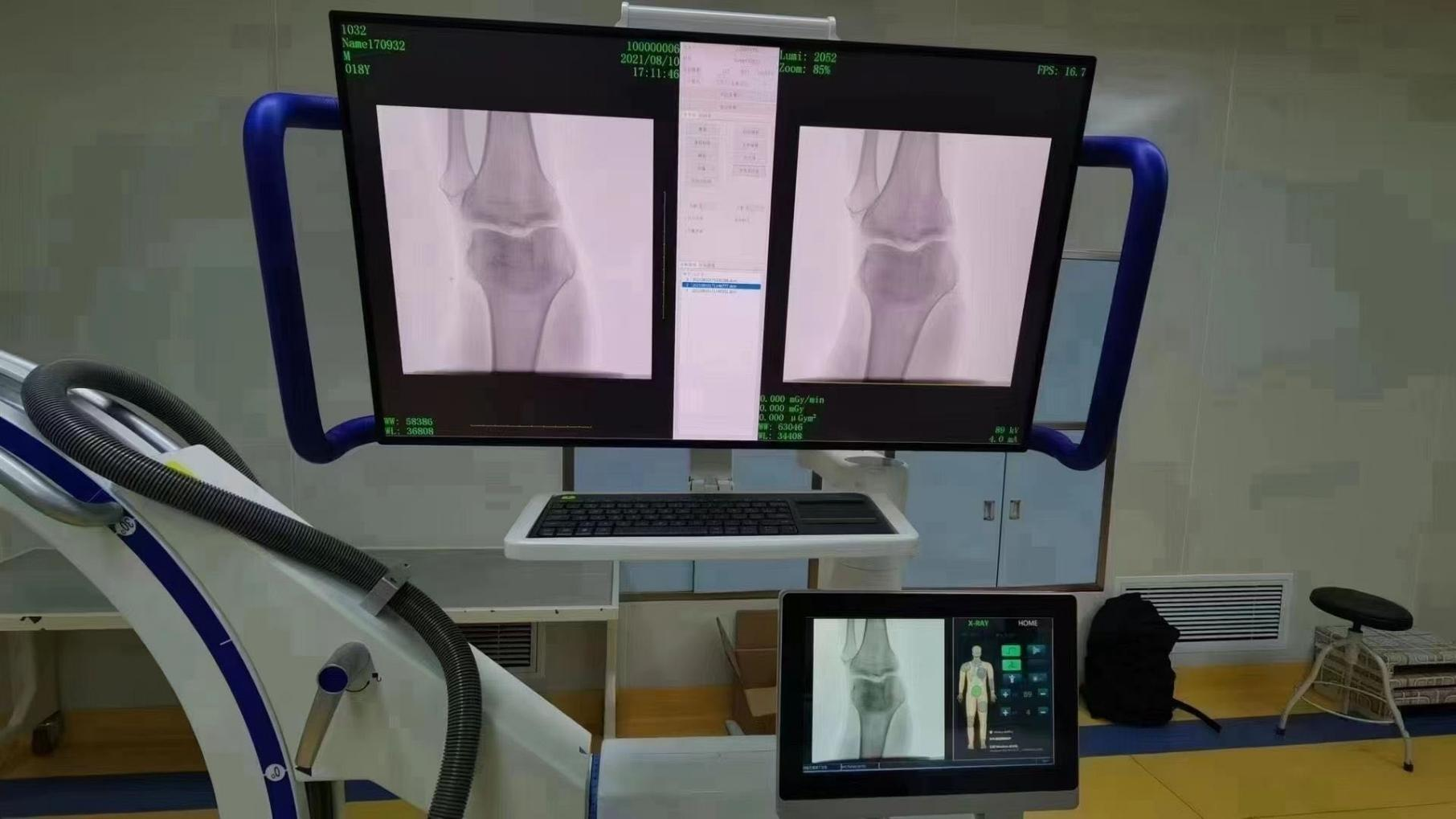 live surgical guidance with our orthopedic x ray c arm.