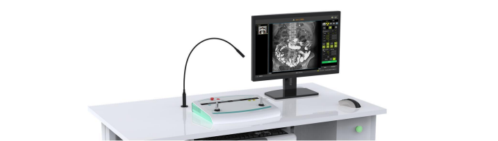 the workstation of the digital x ray system.