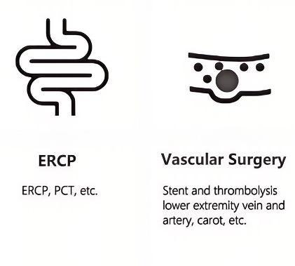 ercp and vacsular surgery of the mobile c arm.