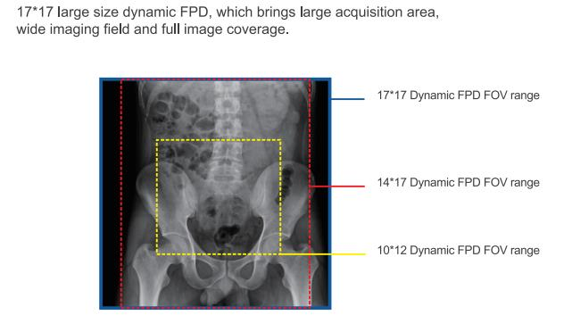 17*17 large size dynamic fpd of the radiography system.