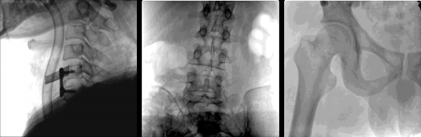 clinical images from syrj c400 c arm machine.