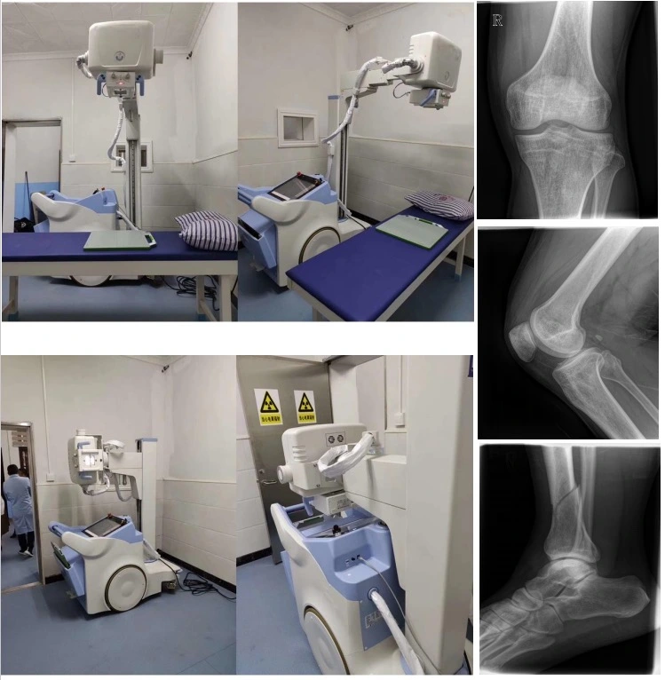 clinical images by the high power portable dr.