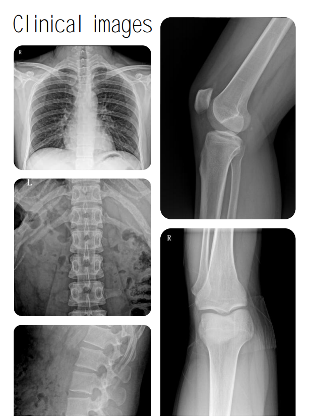clinical images of the portable radiography machine.
