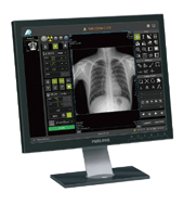 the image workstation of the dr digital radiography.