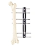 Arm Fixation