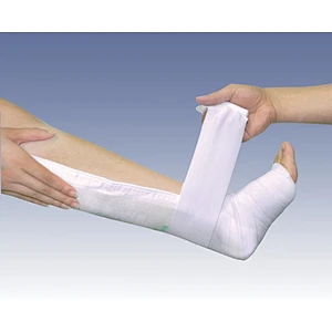 Hospital Supply for Fracture Accidents Medical Fiberglass Polyester Orthopaedic Splints