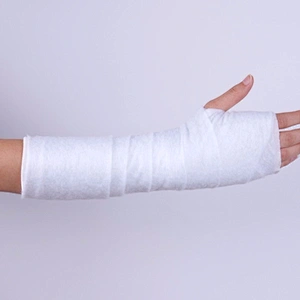 Hospital Supply for Fracture Accidents Medical Fiberglass Polyester Orthopaedic Splints