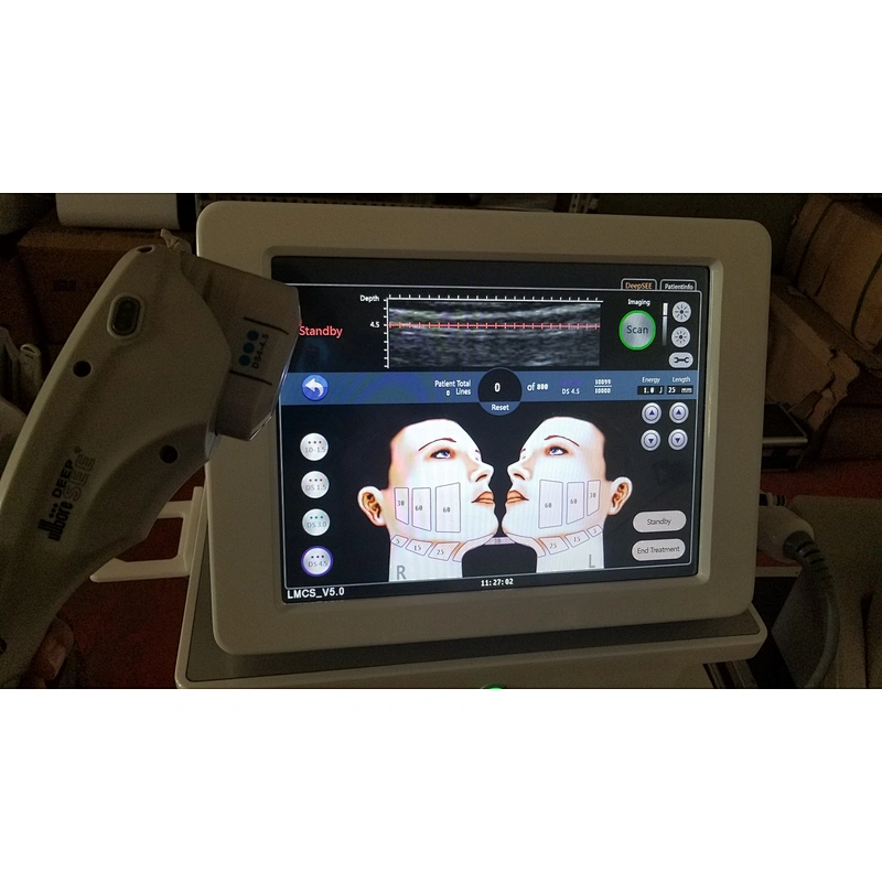 Profesional 3 en 1 hifu cara + cuerpo + vaginal Eliminar arrugas cuerpo adelgazar Vaginal Apretado
