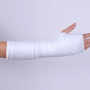 Manufactory Medical High Healing Accidental Injury Quality Orthopaedic Casting Tape