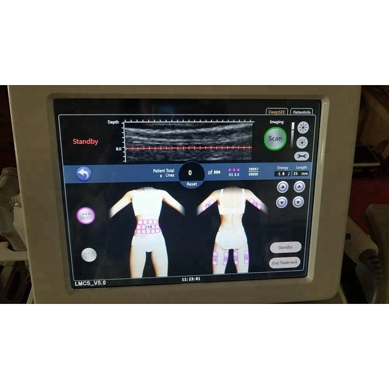 Profesional 3 en 1 hifu cara + cuerpo + vaginal Eliminar arrugas cuerpo adelgazar Vaginal Apretado