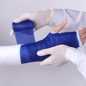 Plaster Treatment of Fractures Medical Orthopedic Fiberglass Cast Tape