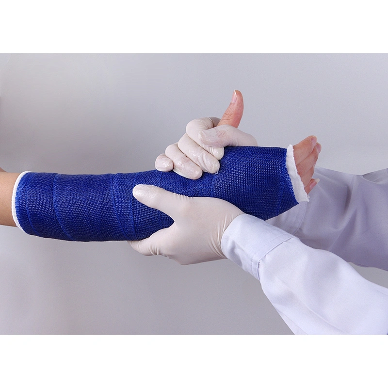 Manufacture Orthopedic Fiberglass/ Polyester Bandage Cast