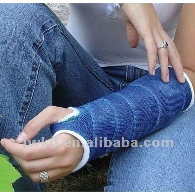 China top quality and CE approved orthopedic polyester casting tape
