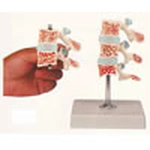 Model Osteoporosis