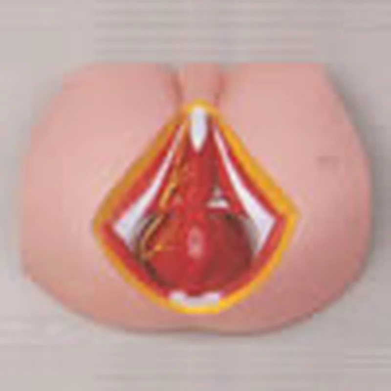 Perineum Lelaki